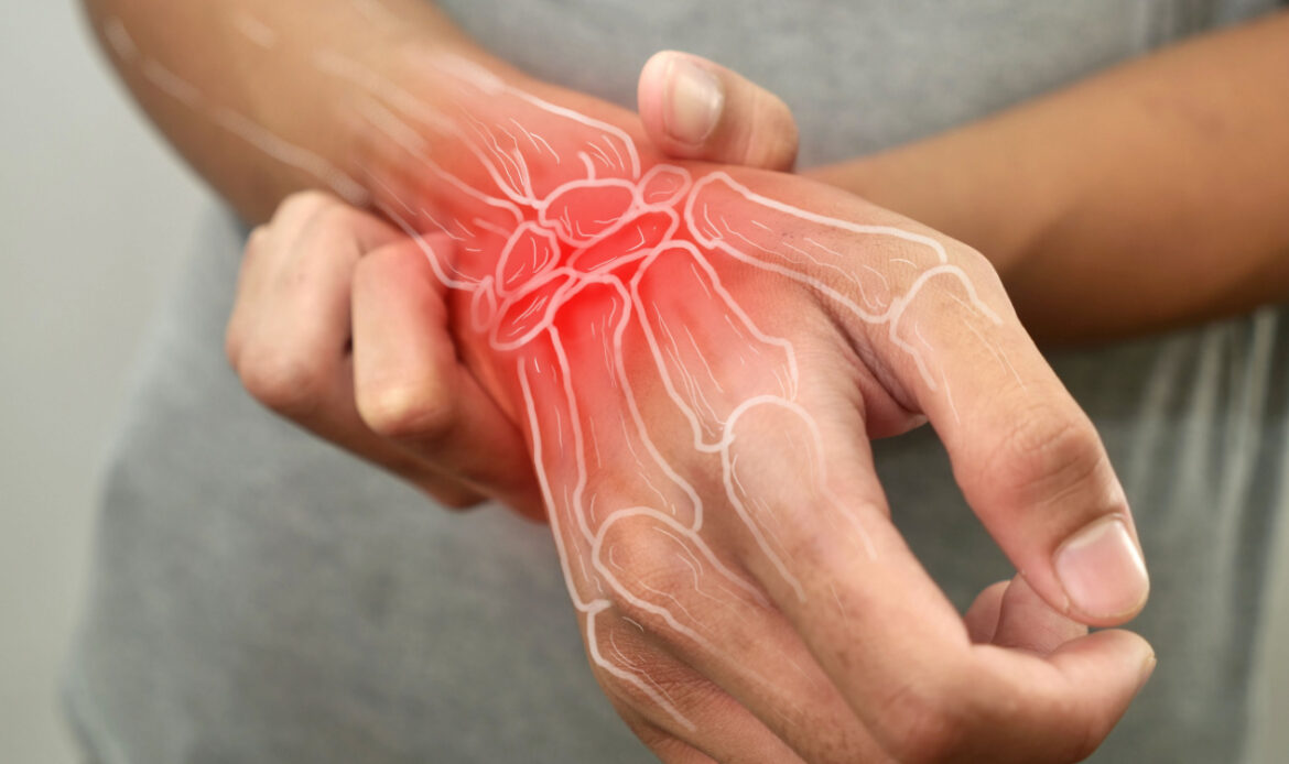 If you are experiencing mild or severe pain in your joints, arthritis may be the culprit. There are over 100 different types of arthritis, resulting in a variety of causes and treatments. Fortunately, the team at Integrated Medical Care is here to help you manage this often debilitating condition.