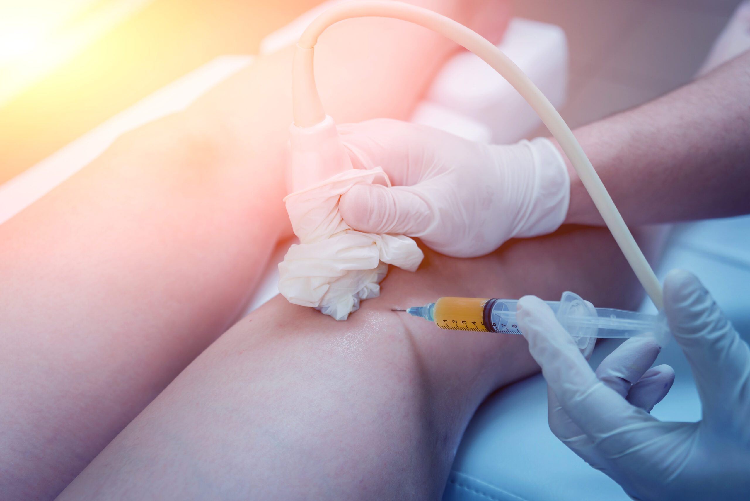 A close-up of someone receiving an ultrasound-guided platelet-rich plasma therapy injection as part of their tendonitis pain treatment.